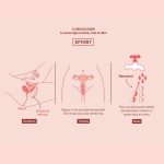 Liebe - Kewos Vaginale Balletjes Peach/Mint gebruik