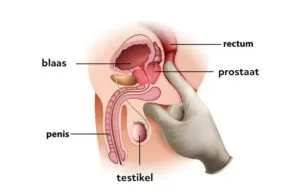 waar zit de prostaat